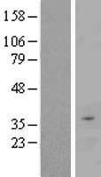 FBXO16 Human Over-expression Lysates NM_172366