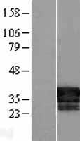 ls157638 lratd2 human over expression lysates nm 174911 wb testing 1