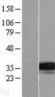 TMEM74 Human Over-expression Lysates NM_153015