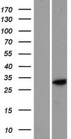 DOCK8-AS1 Human Over-expression Lysates NM_152569