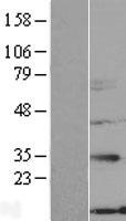 NXNL2 Human Over-expression Lysates NM_145283