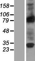 RASEF Human Over-expression Lysates NM_152573