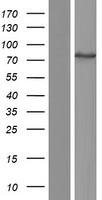 ls158219 ttc39b human over expression lysates nm 001168339 wb testing 2