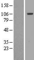 ls158248 ttc16 human over expression lysates nm 144965 wb testing 1