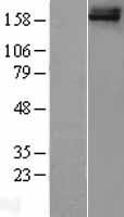 ls158326 frem1 human over expression lysates nm 144966 wb testing 1