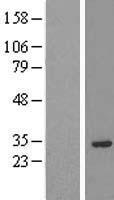 Prune homolog 2 (PRUNE2) Human Over-expression Lysates NM_138818