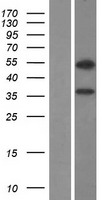 CBLL2 Human Over-expression Lysates NM_152577