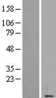 CSAG1 Human Over-expression Lysates NM_153478