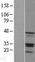 RIBC1 Human Over-expression Lysates NM_001031745