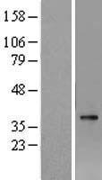 DGAT2L3 (AWAT1) Human Over-expression Lysates NM_001013579