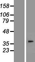 DGAT2L4 (AWAT2) Human Over-expression Lysates NM_001002254