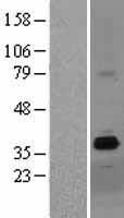 ls158866 zdhhc15 human over expression lysates nm 144969 wb testing 1