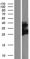 CXorf38 Human Over-expression Lysates NM_144970
