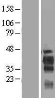 ls159090 fam122b human over expression lysates nm 145284 wb testing 1