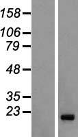 FAM122C Human Over-expression Lysates NM_138819