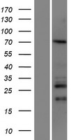 CCDC67 (DEUP1) Human Over-expression Lysates NM_181645