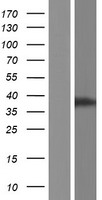 C11orf65 Human Over-expression Lysates NM_152587