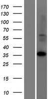 LDHAL6A Human Over-expression Lysates NM_144972
