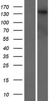 ls160518 dennd5b human over expression lysates nm 144973 wb testing 1