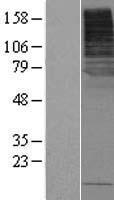 SLC5A8 Human Over-expression Lysates NM_145913