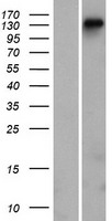 DGKH Human Over-expression Lysates NM_178009