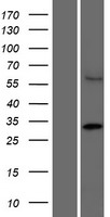 CCDC122 Human Over-expression Lysates NM_144974