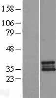 STOML3 Human Over-expression Lysates NM_145286