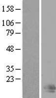 ls161145 tmem229b human over expression lysates nm 182526 wb testing 1
