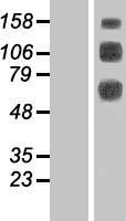 CLEC14A Human Over-expression Lysates NM_175060