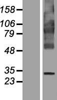 ls161247 fitm1 human over expression lysates nm 203402 wb testing 1