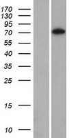 C14orf174 (SAMD15) Human Over-expression Lysates NM_001010860