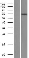 C14ORF21 (NOP9) Human Over-expression Lysates NM_174913