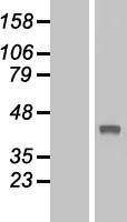 ls161514 tbc1d21 human over expression lysates nm 153356 wb testing 1