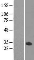 ls161753 odf3l1 human over expression lysates nm 175881 wb testing 1