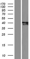 ADAL Human Over-expression Lysates NM_001159280