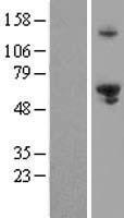 EXDL1 (EXD1) Human Over-expression Lysates NM_152596