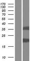 TMEM92 Human Over-expression Lysates NM_001168215