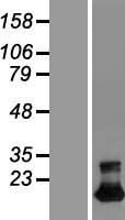TMEM92 Human Over-expression Lysates NM_153229