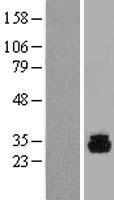 ls162466 phospho1 human over expression lysates nm 178500 wb testing 2