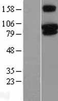 TRPV3 Human Over-expression Lysates NM_145068