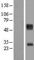 SLC16A11 Human Over-expression Lysates NM_153357