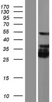KRT28 Human Over-expression Lysates NM_181535