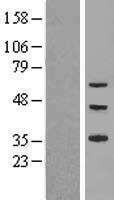 ls162967 znf320 human over expression lysates nm 207333 wb testing 1