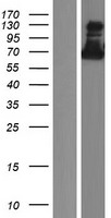ZNF579 Human Over-expression Lysates NM_152600