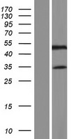 C19orf46 (SYNE4) Human Over-expression Lysates NM_001039876