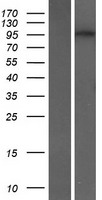ls163259 dennd2c human over expression lysates nm 198459 wb testing 1