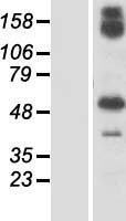GBP6 Human Over-expression Lysates NM_198460