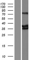ls163404 pap2d plppr5 human over expression lysates nm 001010861 wb testing 1