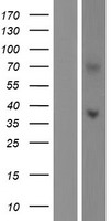 ls163404 pap2d plppr5 human over expression lysates nm 001037317 wb testing 2