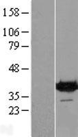 DENND1B Human Over-expression Lysates NM_144977